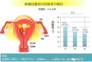 日本做试管婴儿花多少钱？| 附收费详情